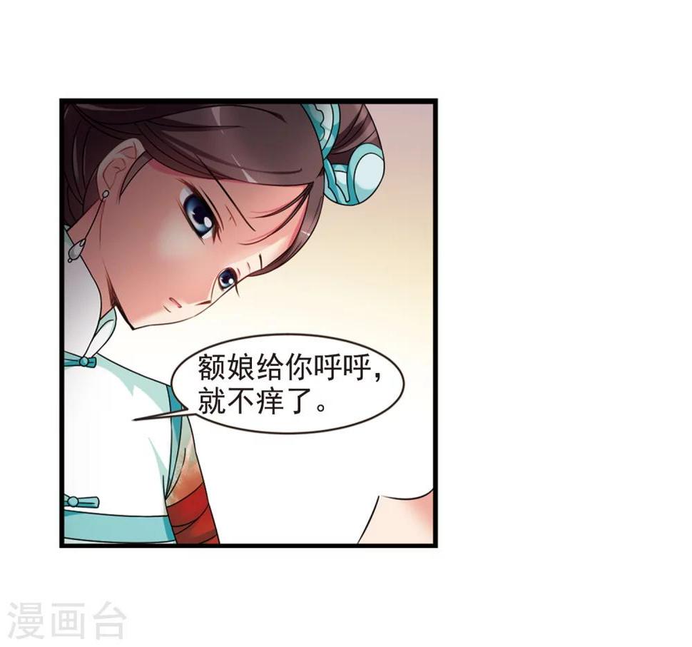 《妃夕妍雪》漫画最新章节第449话 天花2免费下拉式在线观看章节第【45】张图片