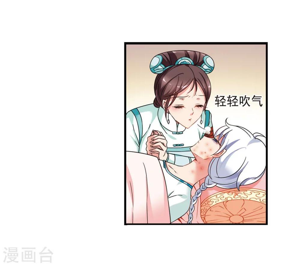 《妃夕妍雪》漫画最新章节第449话 天花2免费下拉式在线观看章节第【46】张图片