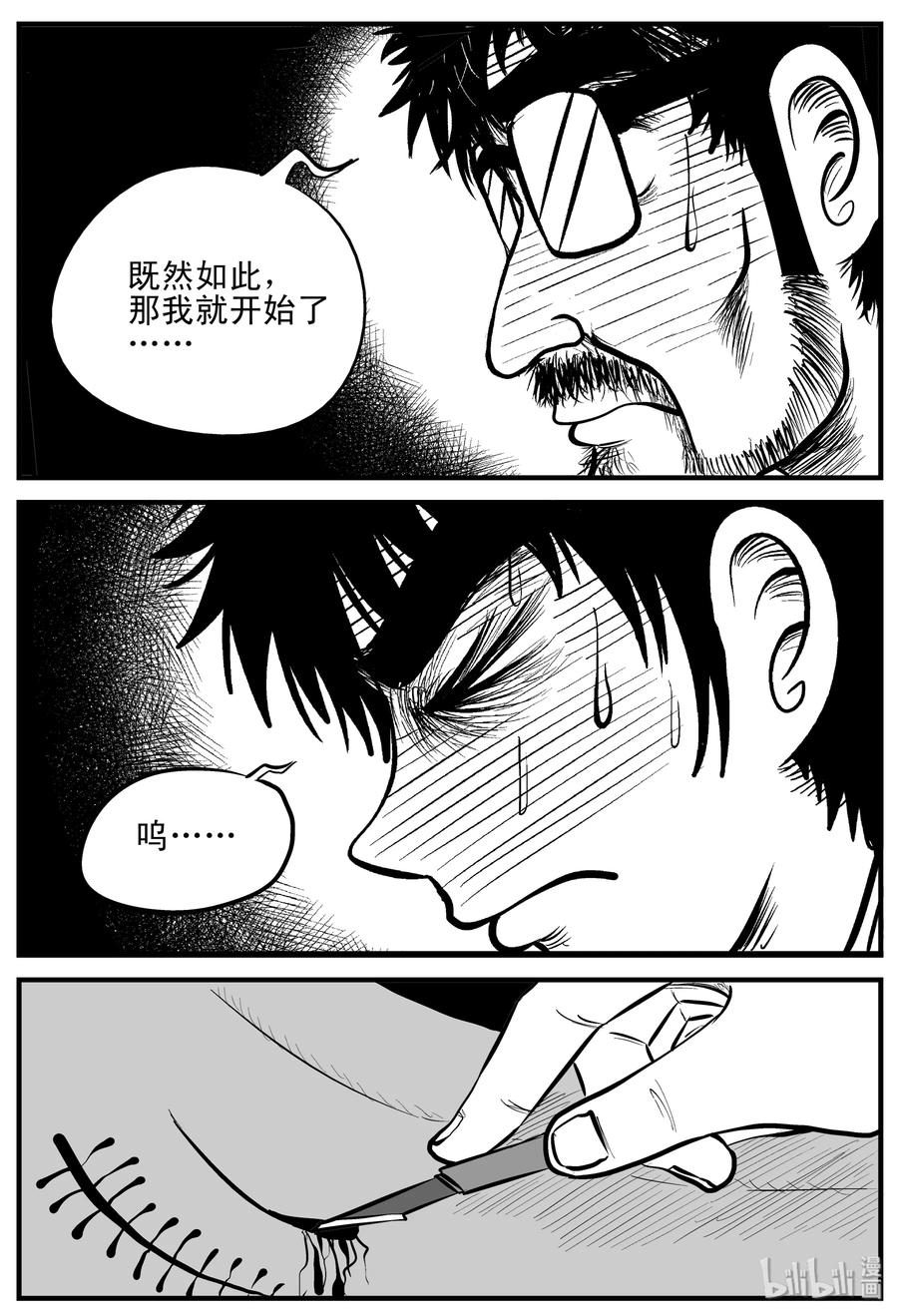 《小智怪谈》漫画最新章节206 谁偷了我的肾（2）免费下拉式在线观看章节第【17】张图片