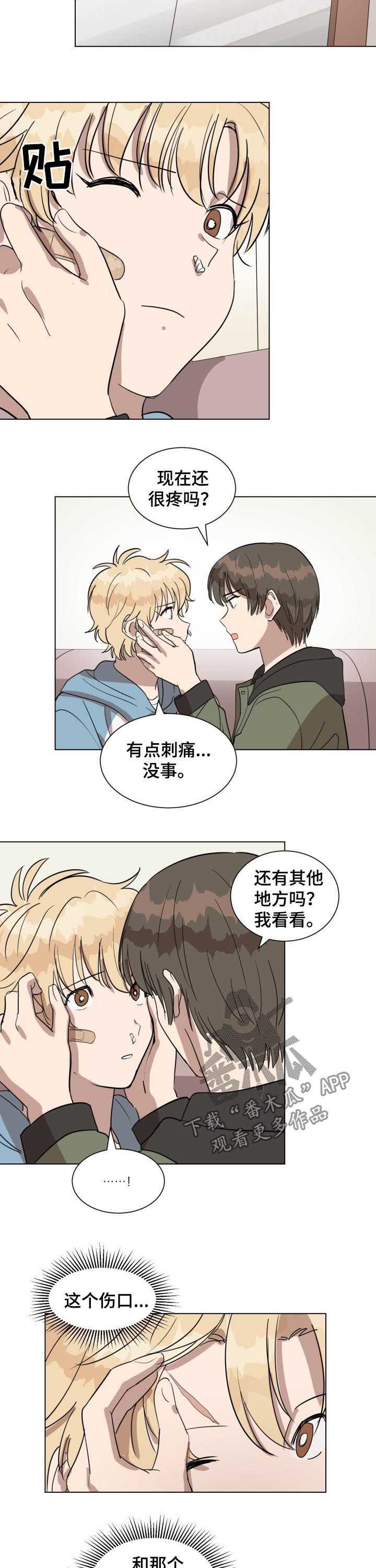 《美丽的误会》漫画最新章节第23章：伤口免费下拉式在线观看章节第【4】张图片