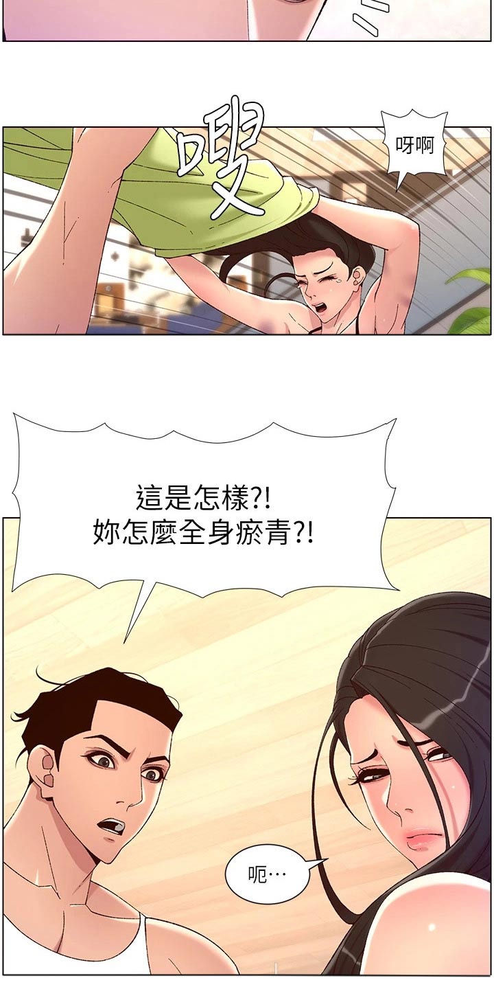 《帝王软件》漫画最新章节第52章：淤青免费下拉式在线观看章节第【9】张图片