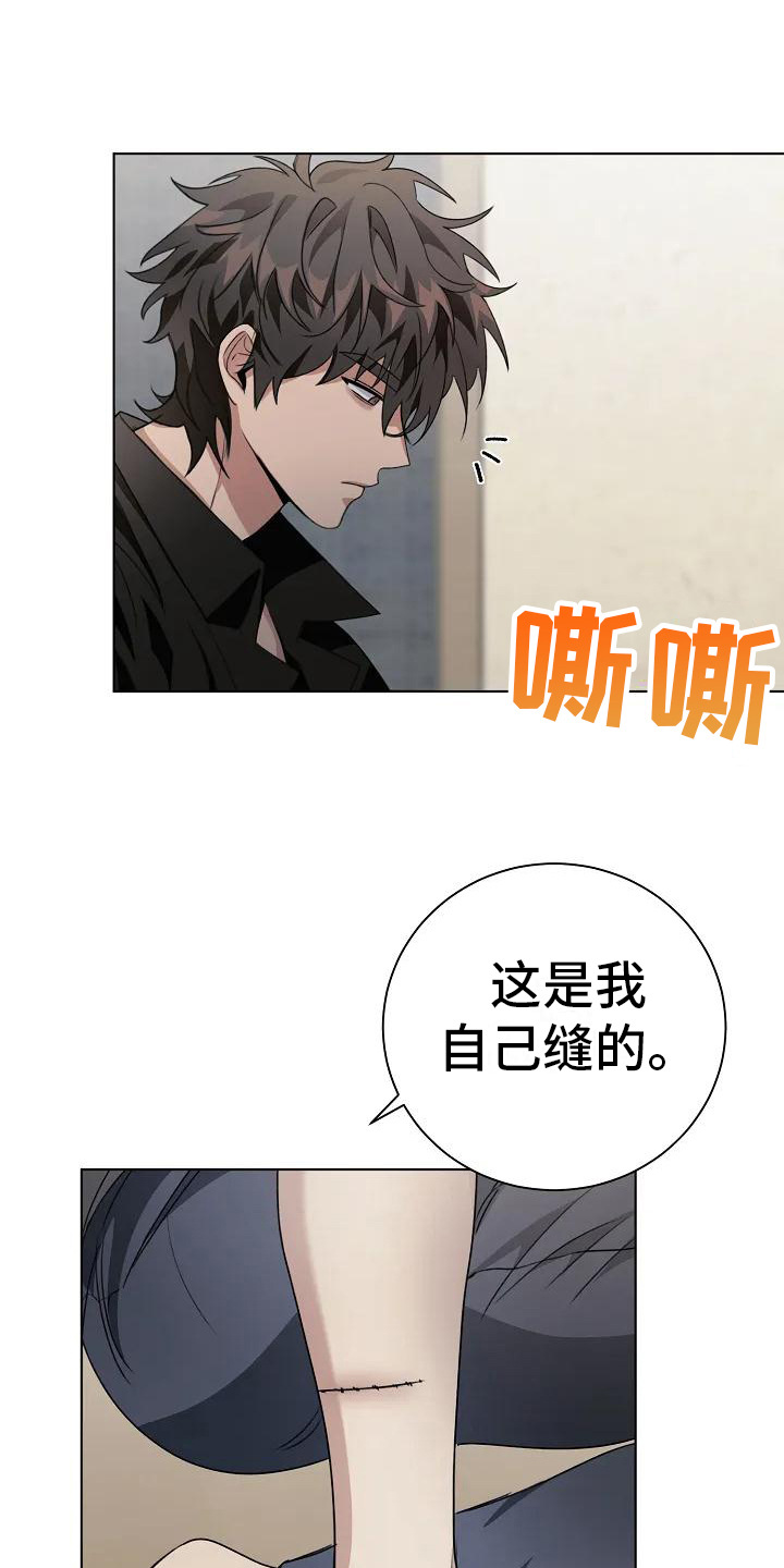 《奇怪的邻居》漫画最新章节第9章：缝针免费下拉式在线观看章节第【6】张图片