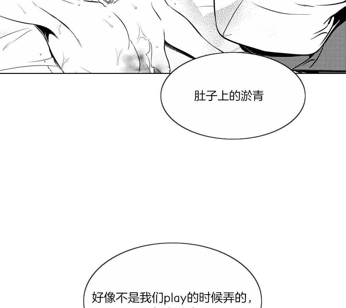 《我的主播男友（全集&番外）》漫画最新章节第146话_淤青免费下拉式在线观看章节第【27】张图片